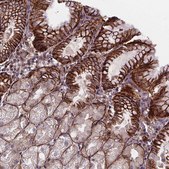 Anti-AEBP1 antibody produced in rabbit Prestige Antibodies&#174; Powered by Atlas Antibodies, affinity isolated antibody, buffered aqueous glycerol solution