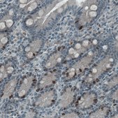 Monoclonal Anti-MKI67 antibody produced in mouse Prestige Antibodies&#174; Powered by Atlas Antibodies, clone CL1234, purified immunoglobulin, buffered aqueous glycerol solution