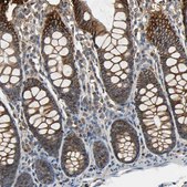 Anti-NDRG1 antibody produced in rabbit Prestige Antibodies&#174; Powered by Atlas Antibodies, affinity isolated antibody, buffered aqueous glycerol solution