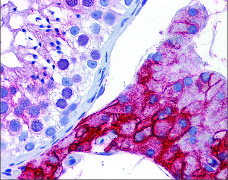 Anti-ACE2 antibody produced in rabbit affinity isolated antibody