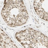 Anti-KIF11 antibody produced in rabbit Prestige Antibodies&#174; Powered by Atlas Antibodies, affinity isolated antibody, buffered aqueous glycerol solution
