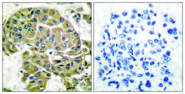 Anti-Mammaglobin B antibody produced in rabbit affinity isolated antibody