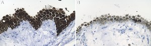 Anti-RPE65 Antibody, clone 401.8B11.3D9 ZooMAb&#174; Mouse Monoclonal recombinant, expressed in HEK 293 cells