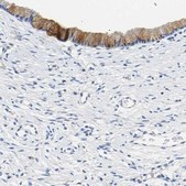 Anti-CHAD antibody produced in rabbit affinity isolated antibody, buffered aqueous glycerol solution