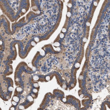 Anti-VPS13A antibody produced in rabbit Prestige Antibodies&#174; Powered by Atlas Antibodies, affinity isolated antibody, buffered aqueous glycerol solution, Ab2