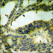 Anti-phospho-Catenin-&#946; (pTyr489) antibody produced in rabbit affinity isolated antibody