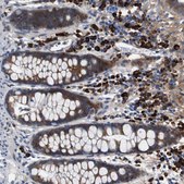 Anti-UBE2G2 antibody produced in rabbit Prestige Antibodies&#174; Powered by Atlas Antibodies, affinity isolated antibody, buffered aqueous glycerol solution