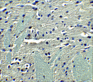 Anti-Adiponectin (ab1) antibody produced in rabbit affinity isolated antibody, buffered aqueous solution