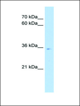 Anti-POU6F1 (AB2) antibody produced in rabbit affinity isolated antibody