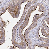 Anti-CD47 antibody produced in rabbit Prestige Antibodies&#174; Powered by Atlas Antibodies, affinity isolated antibody, buffered aqueous glycerol solution