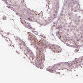 Anti-CELSR3 antibody produced in rabbit Prestige Antibodies&#174; Powered by Atlas Antibodies, affinity isolated antibody, buffered aqueous glycerol solution