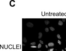 Monoclonal Anti-Fibronectin antibody produced in mouse clone IST-4, ascites fluid