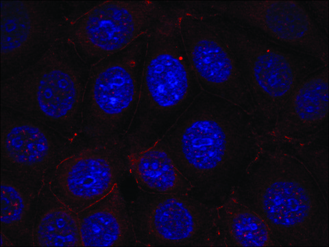 Anti-phospho-IGF1R (pTyr1165/pTyr1166) antibody produced in rabbit affinity isolated antibody