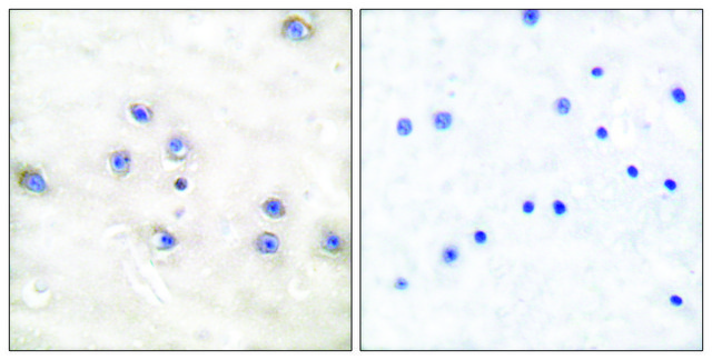 Anti-COT antibody produced in rabbit affinity isolated antibody