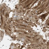 Anti-PDE3A antibody produced in rabbit Prestige Antibodies&#174; Powered by Atlas Antibodies, affinity isolated antibody, buffered aqueous glycerol solution