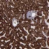 Anti-MAOB antibody produced in rabbit Prestige Antibodies&#174; Powered by Atlas Antibodies, affinity isolated antibody, buffered aqueous glycerol solution