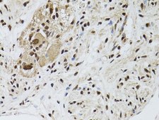 Anti-LKB1 antibody produced in rabbit