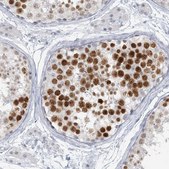 Anti-SCML1 antibody produced in rabbit Prestige Antibodies&#174; Powered by Atlas Antibodies, affinity isolated antibody, buffered aqueous glycerol solution
