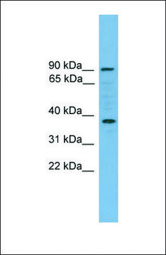 Anti-HGF antibody produced in rabbit affinity isolated antibody