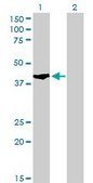 Monoclonal Anti-SHOX2 antibody produced in mouse clone 1D1, purified immunoglobulin, buffered aqueous solution
