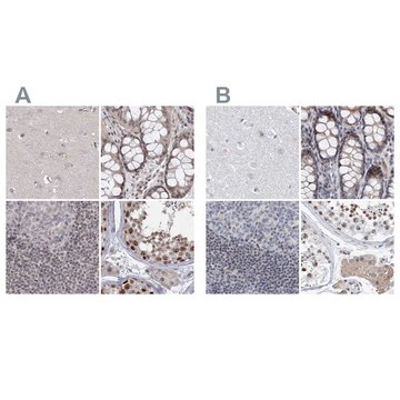 Anti-UIMC1 antibody produced in rabbit Prestige Antibodies&#174; Powered by Atlas Antibodies, affinity isolated antibody, buffered aqueous glycerol solution