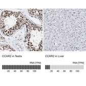 Anti-CCAR2 antibody produced in rabbit Prestige Antibodies&#174; Powered by Atlas Antibodies, affinity isolated antibody, buffered aqueous glycerol solution, Ab1