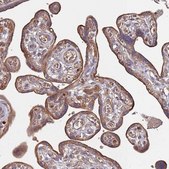 Anti-ATG5 antibody produced in rabbit Prestige Antibodies&#174; Powered by Atlas Antibodies, affinity isolated antibody, buffered aqueous glycerol solution