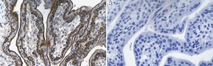 Anti-CD46 Antibody, clone 1C10 ZooMAb&#174; Rabbit Monoclonal recombinant, expressed in HEK 293 cells