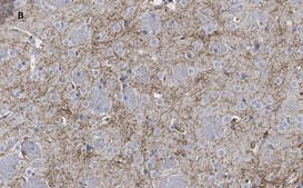 Anti-Tyrosine Hydroxylase Antibody, clone 3M12, ZooMAb&#174; Rabbit Monoclonal recombinant, expressed in HEK 293 cells