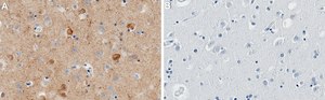 Anti-Rab10 Antibody, clone 1G2 ZooMAb&#174; Rabbit Monoclonal recombinant, expressed in HEK 293 cells