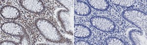 Anti-Histone H3-Lys9me3 Antibody, clone 4J8 ZooMAb&#174; Rabbit Monoclonal recombinant, expressed in HEK 293 cells