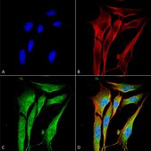 Monoclonal Anti-Mmp9 - Fitc antibody produced in mouse clone S51-82, purified immunoglobulin