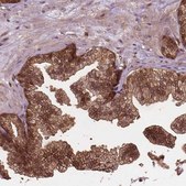 Anti-PLIN3 antibody produced in rabbit Prestige Antibodies&#174; Powered by Atlas Antibodies, affinity isolated antibody, buffered aqueous glycerol solution