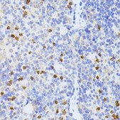 Anti-SMAD2 antibody produced in rabbit