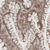 Anti-KIF21B antibody produced in rabbit Prestige Antibodies&#174; Powered by Atlas Antibodies, affinity isolated antibody, buffered aqueous glycerol solution