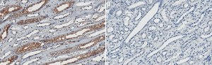 Anti-KIF5B Antibody, clone 2F23 ZooMAb&#174; Rabbit Monoclonal recombinant, expressed in HEK 293 cells