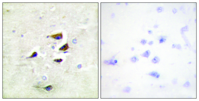 Anti-CAMK2 antibody produced in rabbit affinity isolated antibody