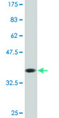 Monoclonal Anti-CBFA2T2 antibody produced in mouse clone 2C10, purified immunoglobulin, buffered aqueous solution