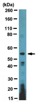 Anti-ETS1 DBD Antibody, clone 1ET 7F2 ascites fluid, clone 1ET 7F2, from mouse