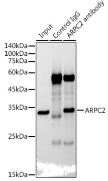 Anti-ARPC2 Antibody, clone 4F2G6, Rabbit Monoclonal