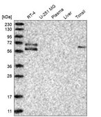 Anti-GGT6 antibody produced in rabbit Prestige Antibodies&#174; Powered by Atlas Antibodies, affinity isolated antibody, buffered aqueous glycerol solution