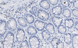 Anti-p-histone H2A (Ser139) Antibody, clone JBW301 ZooMAb&#174; Mouse Monoclonal recombinant, expressed in HEK 293 cells