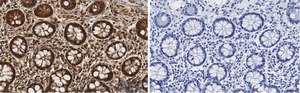 Anti-PSMB2 Antibody, clone 2N18 ZooMAb&#174; Rabbit Monoclonal recombinant, expressed in HEK 293 cells