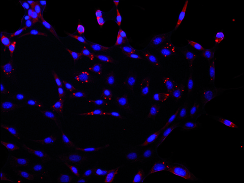 Anti-DCP2 (C-terminal) antibody produced in rabbit ~1&#160;mg/mL, affinity isolated antibody, buffered aqueous solution