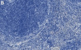 Anti-Integrin &#945;4/CD49d Antibody, clone 1C21 ZooMAb&#174; Rabbit Monoclonal recombinant, expressed in HEK 293 cells