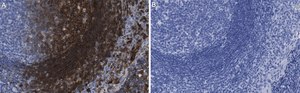 Anti-p-ZAP-70 (Tyr319) Antibody, clone 1B10 ZooMAb&#174; Rabbit Monoclonal recombinant, expressed in HEK 293 cells