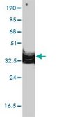 Monoclonal Anti-ANXA2 antibody produced in mouse clone 3E8-B6, purified immunoglobulin, buffered aqueous solution