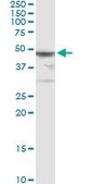 Monoclonal Anti-HGD, (C-terminal) antibody produced in mouse clone 2C10, purified immunoglobulin, buffered aqueous solution