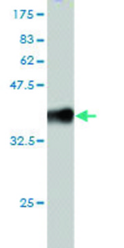 Monoclonal Anti-RNF20 antibody produced in mouse clone 1C6, purified immunoglobulin, buffered aqueous solution