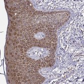 Anti-BACH1 antibody produced in rabbit Prestige Antibodies&#174; Powered by Atlas Antibodies, affinity isolated antibody